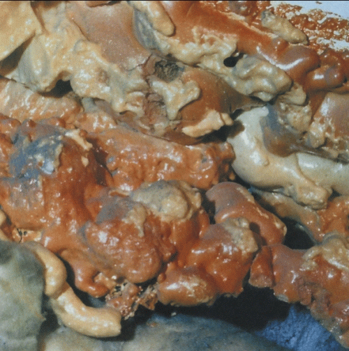 Rot Crumble Collapse